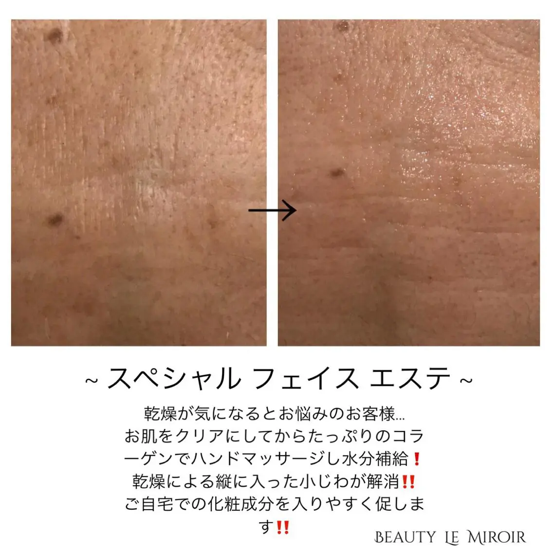 ビューティー ミロワールのエステ・リラクイメージ
