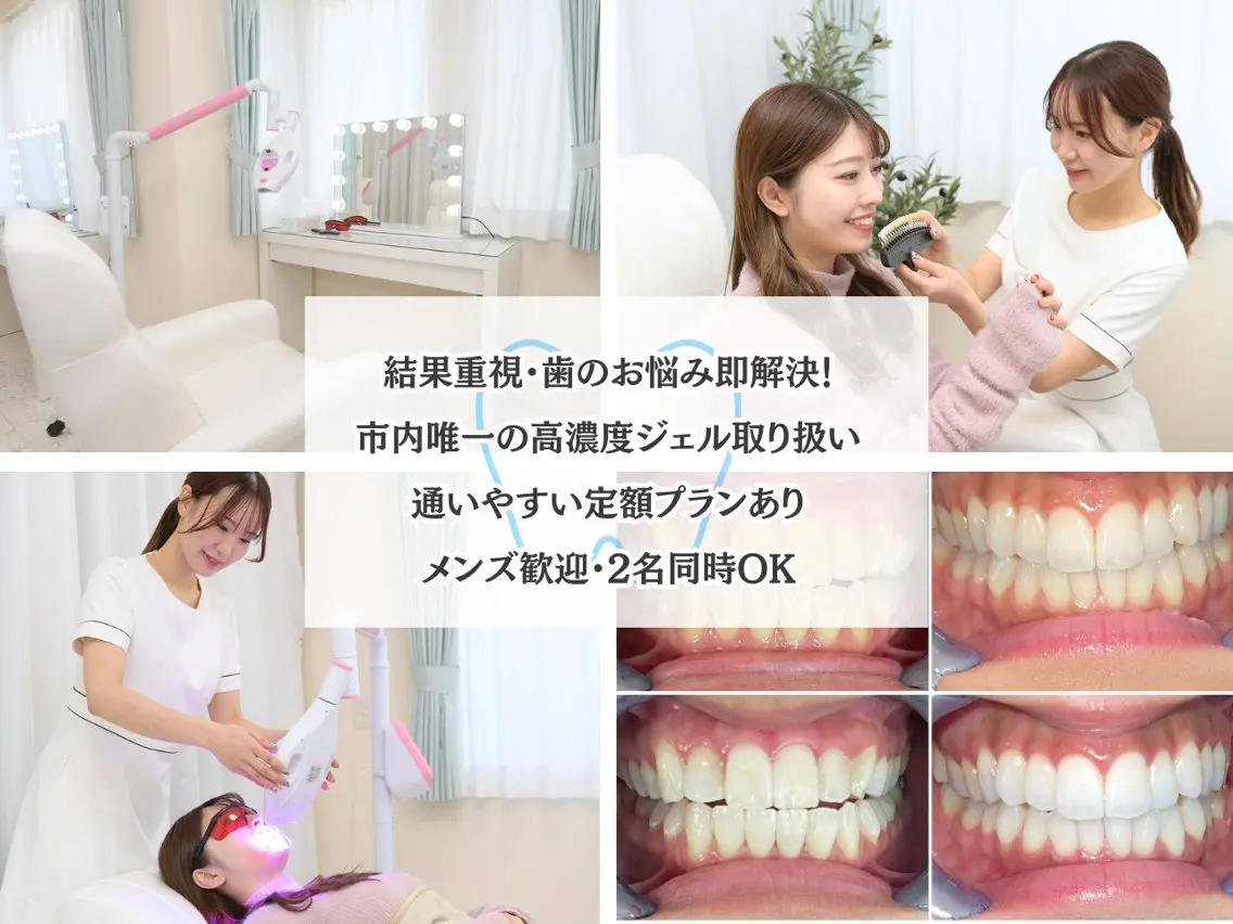 その他 ホワイトニング/脱毛 専門店エクシア岡崎店のその他イメージ