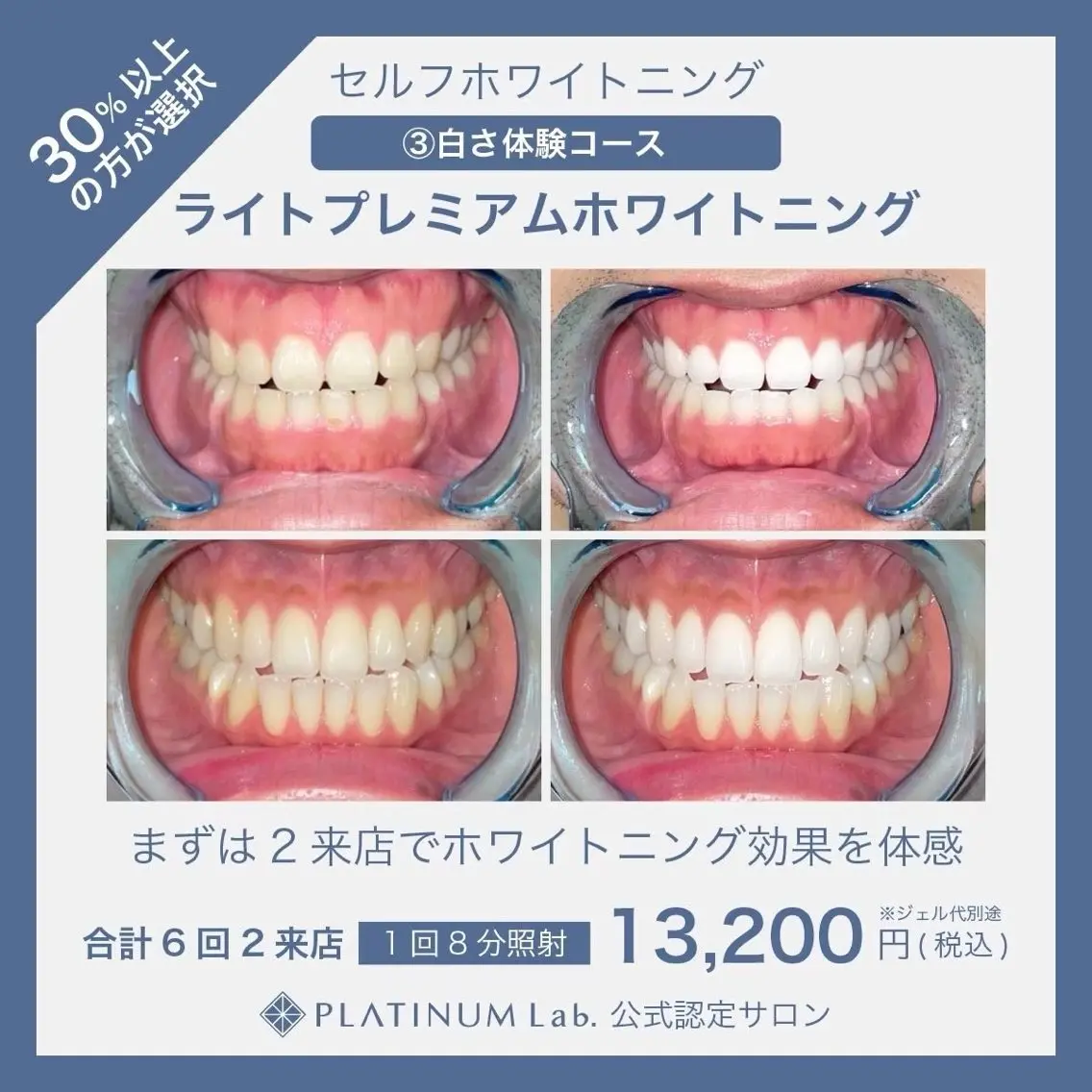 エステ リラク ホワイトニングビュー ティー岡山倉敷店のエステ・リラクイメージ