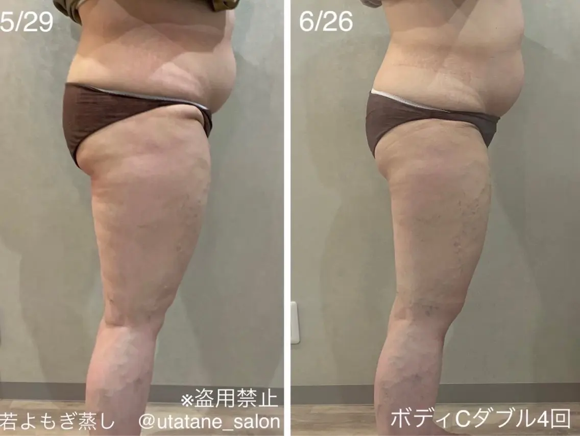 若よもぎ蒸し/脳洗浄 艶肌wax脱毛のエステ・リラクイメージ
