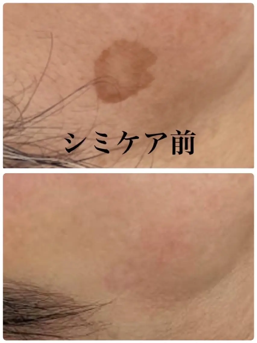 エステ babyaiai 　momo🍑のエステ・リラクイメージ