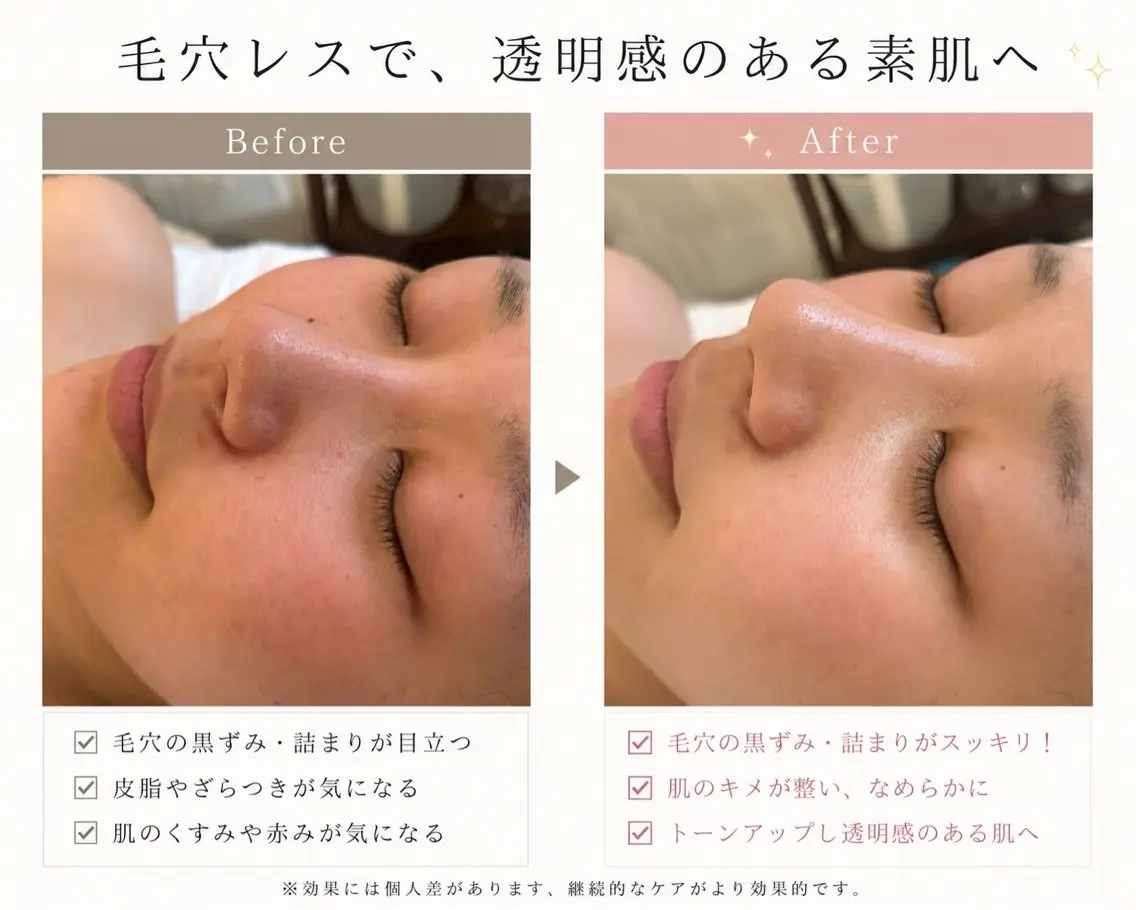 POLA 美肌｜毛穴｜肌質改善のエステ・リラクイメージ