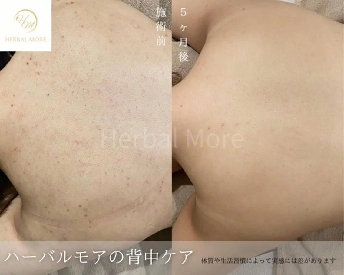 脱毛・眉毛・フェイス サロンN久留米店の眉毛・アイブロウイメージ