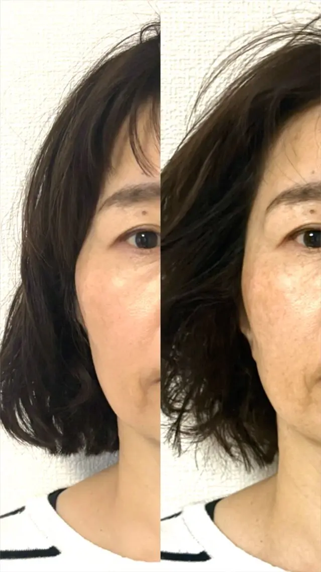 maryu 358のエステ・リラクイメージ