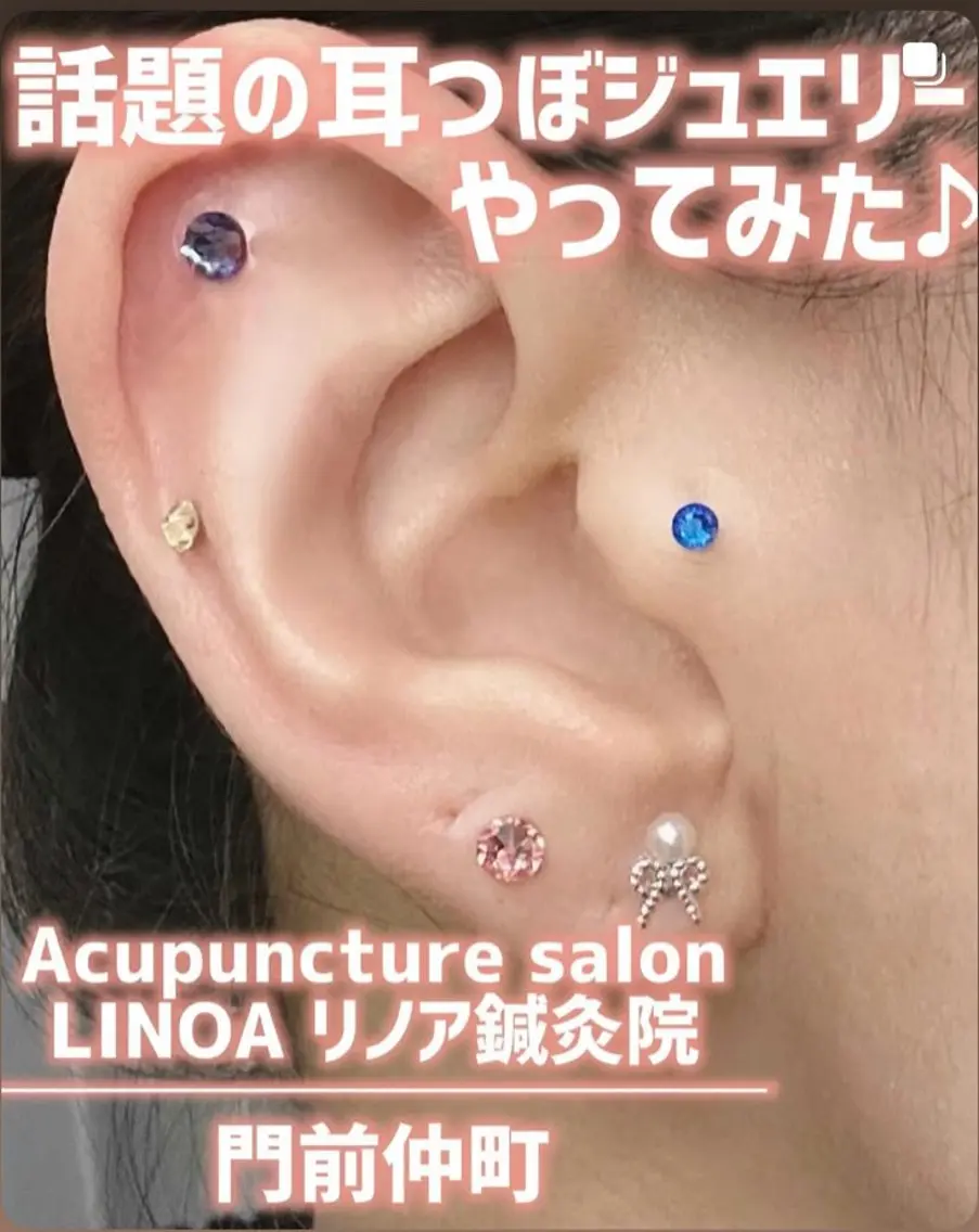 夏にピッタリ☀️高級スワロフスキー耳ツボジュエリー💎体験!耳でも目元でも施術可能です✨の写真