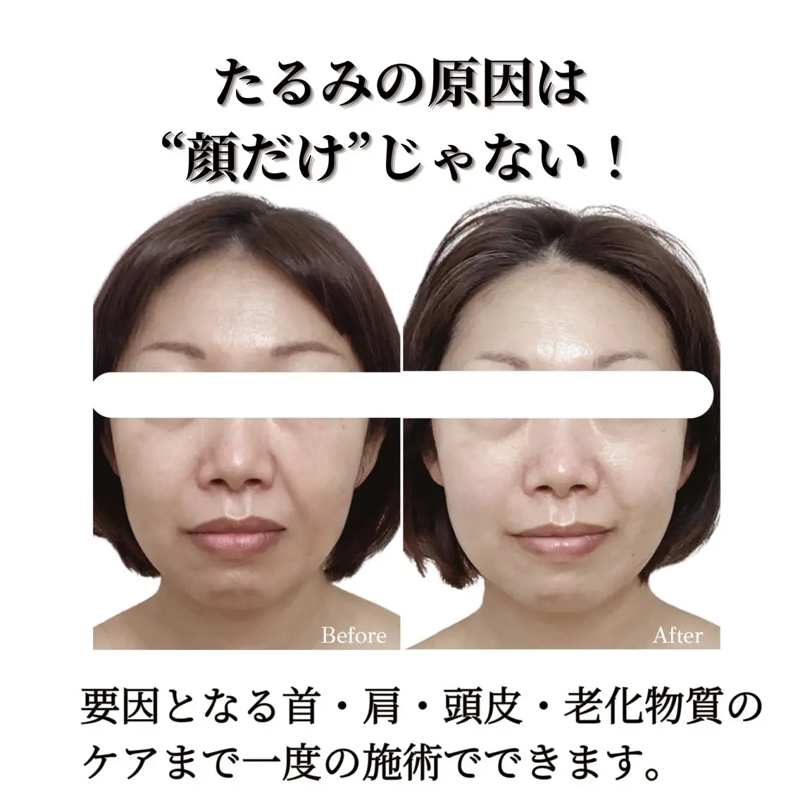 看護師 AYUIのエステ・リラクイメージ