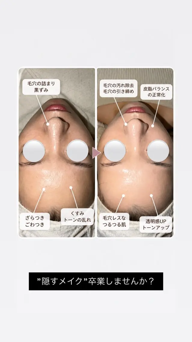 エステ Raviy 【痩身専門・肌管理】のエステ・リラクイメージ