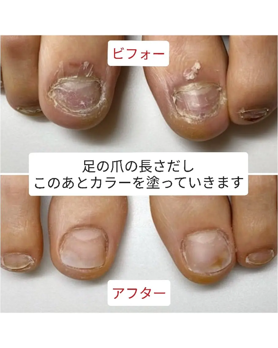 ネイル フットネイル フットネイル ネイルサロン アリュームのネイルデザイン