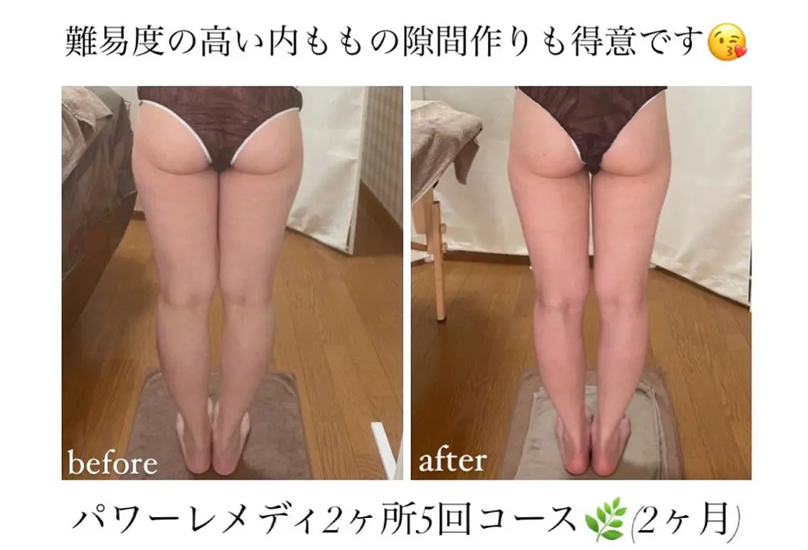 《本気痩せ×疲労改善 》 BILOOPのエステ・リラクイメージ