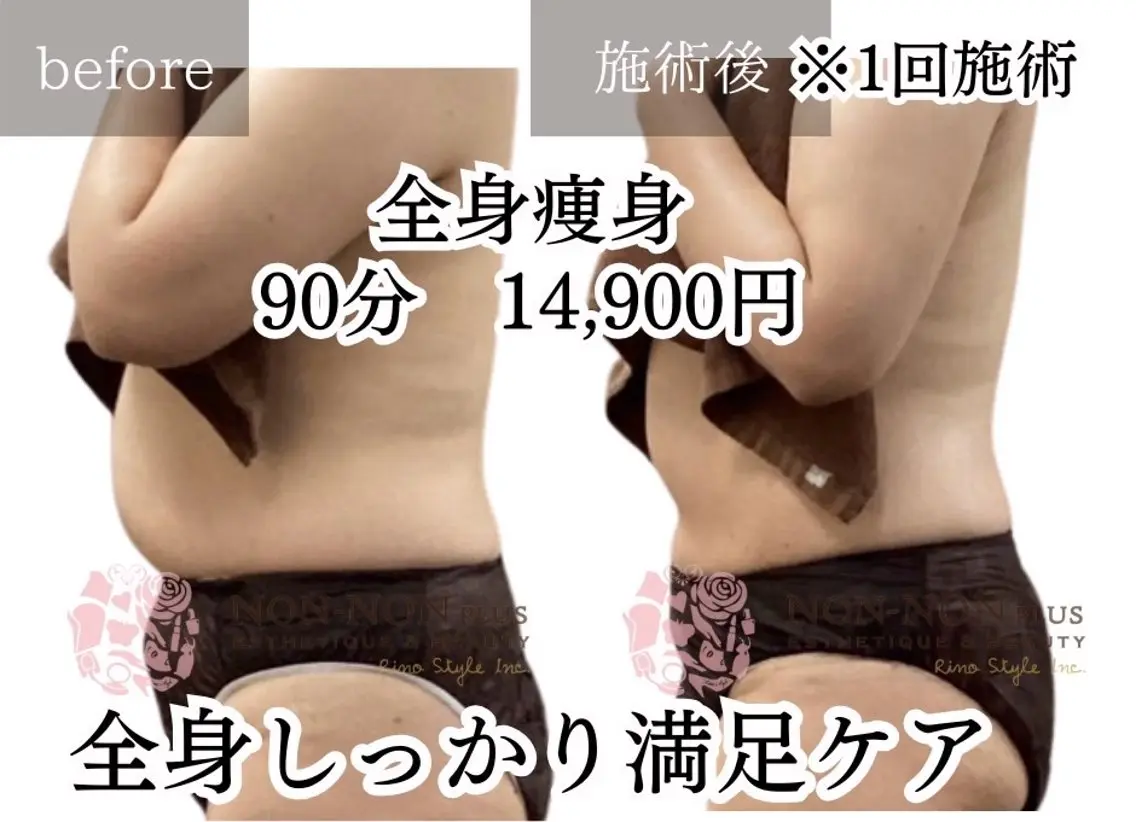 エステ リラク NON-NONプラス 大人の本気痩身のエステ・リラクイメージ