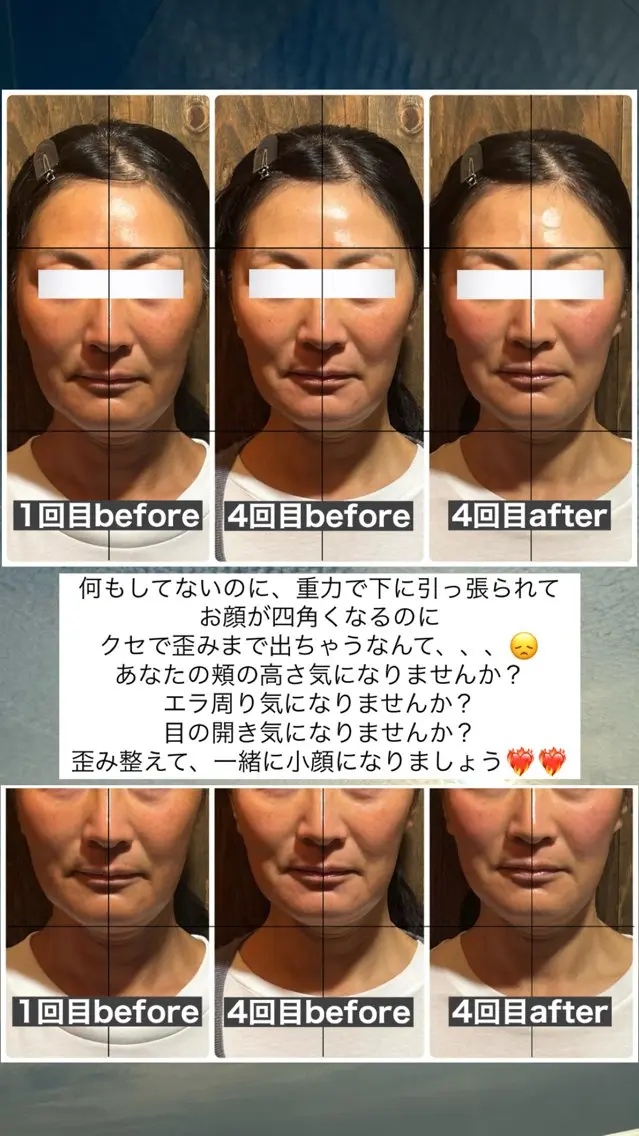エステ リラク 💎後悔させない小顔 矯正💎イトヤマ🌱のエステ・リラクイメージ