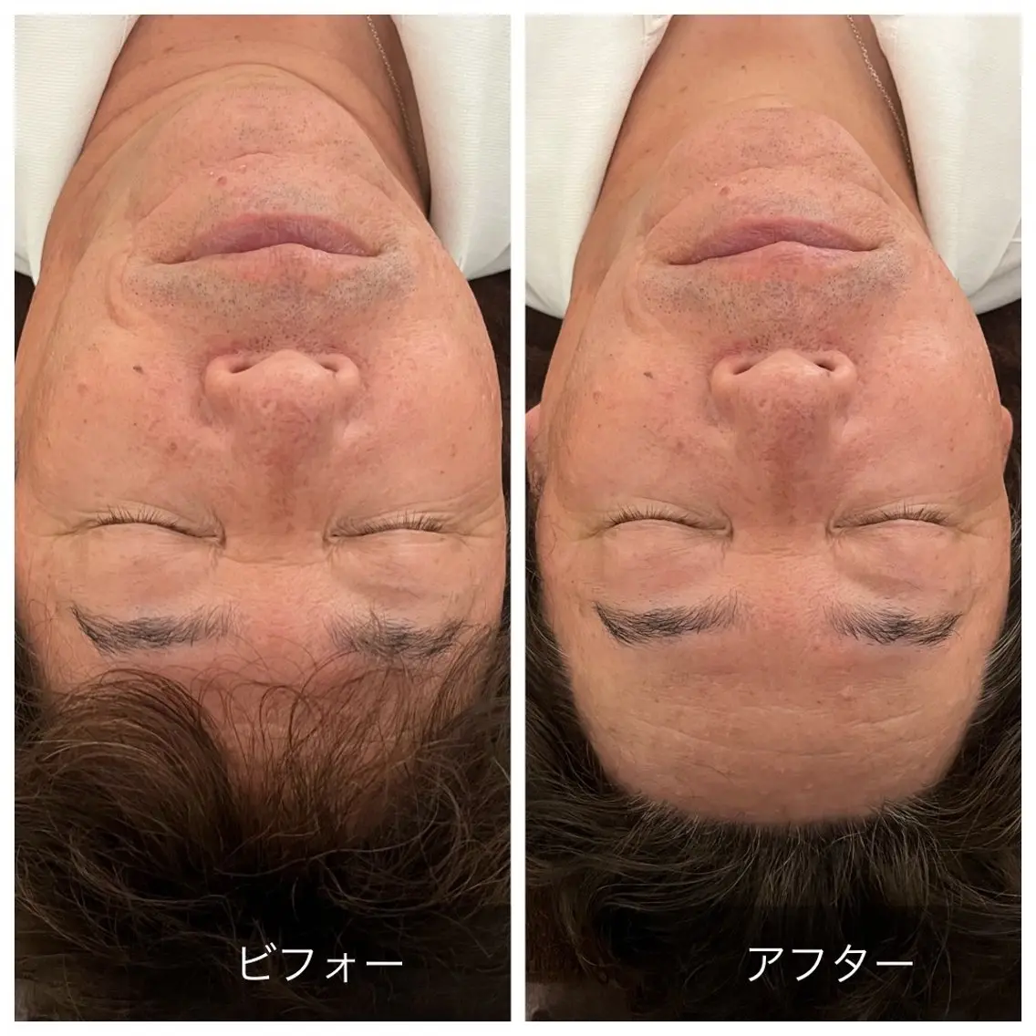 Relaxsalon undoのエステ・リラクイメージ