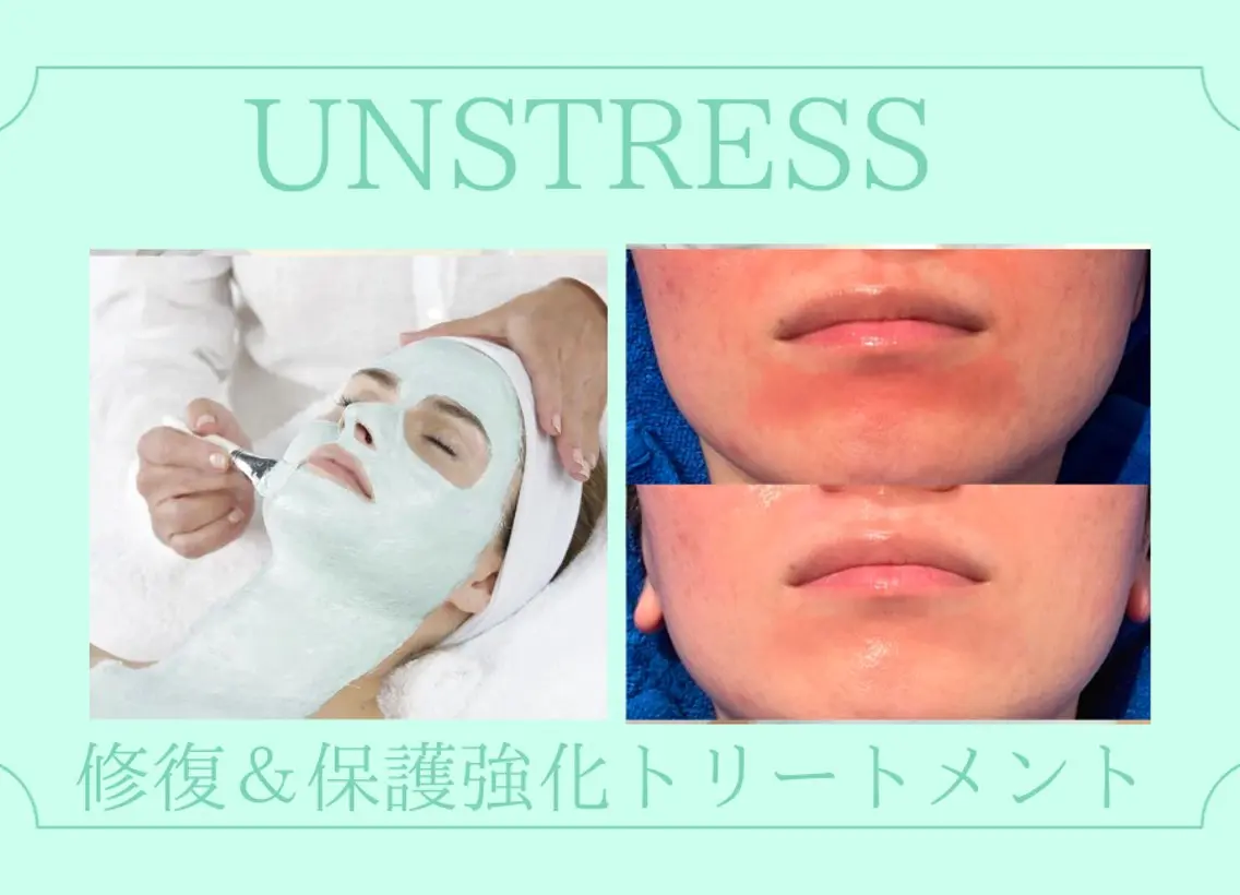 エステ BestBelleꕤ 大阪福島/肌質改善のエステ・リラクイメージ