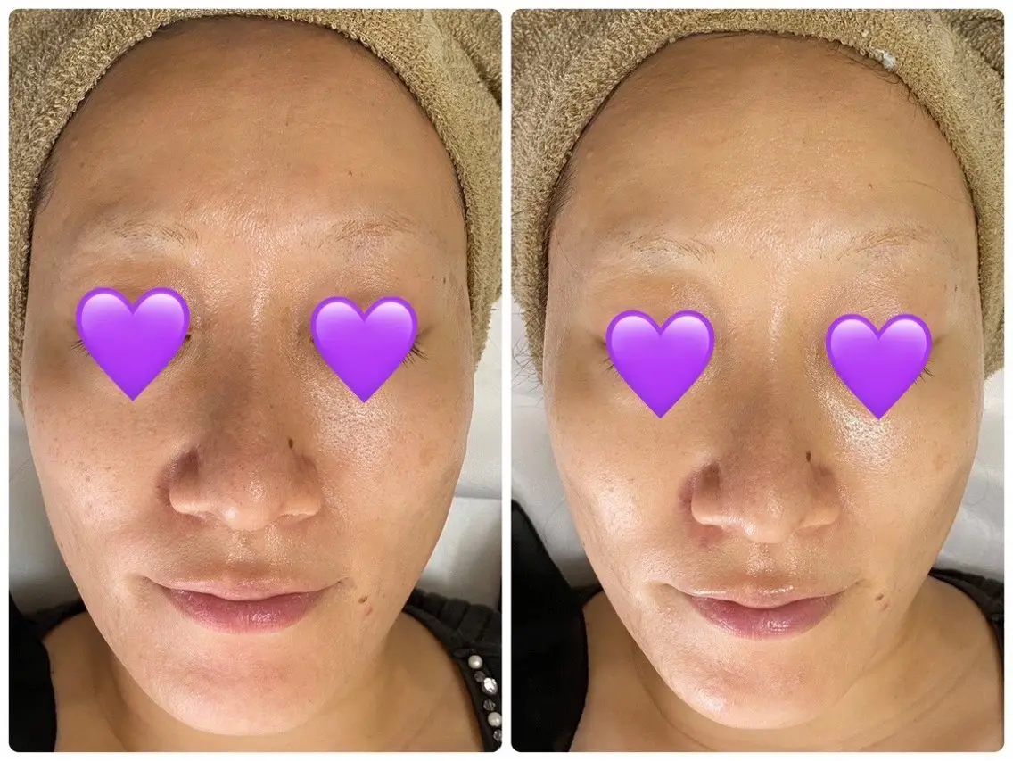 エステ COCO beautyサロンのエステ・リラクイメージ