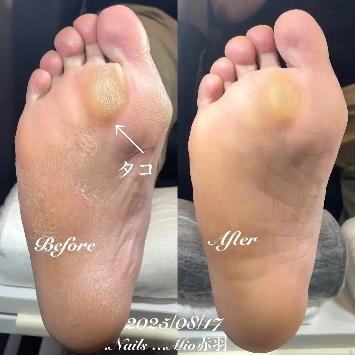 ネイル フットネイル .Nails Mio 赤羽西ネイルサロンのネイルデザイン