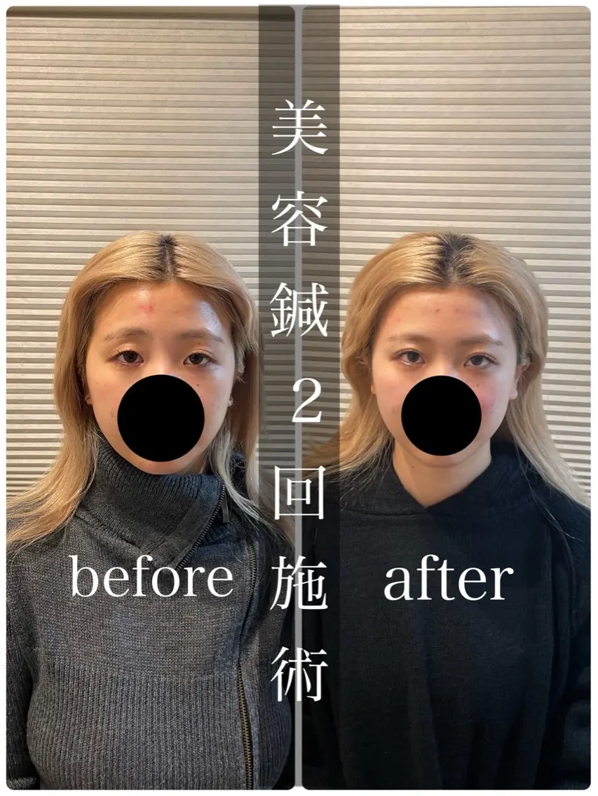 鍼灸 Refineのその他イメージ