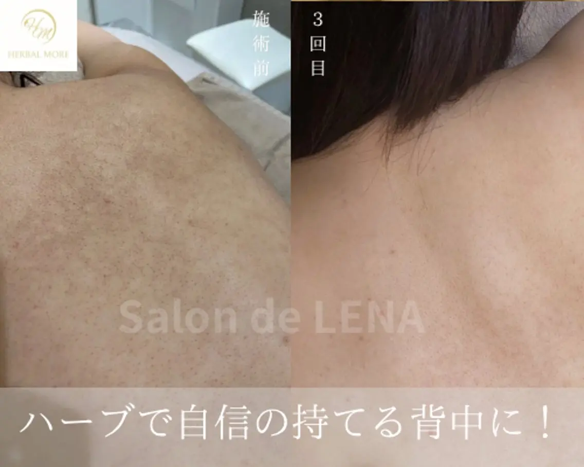 エステ ハーブピーリング専門 サロンドレナ平岡のエステ・リラクイメージ
