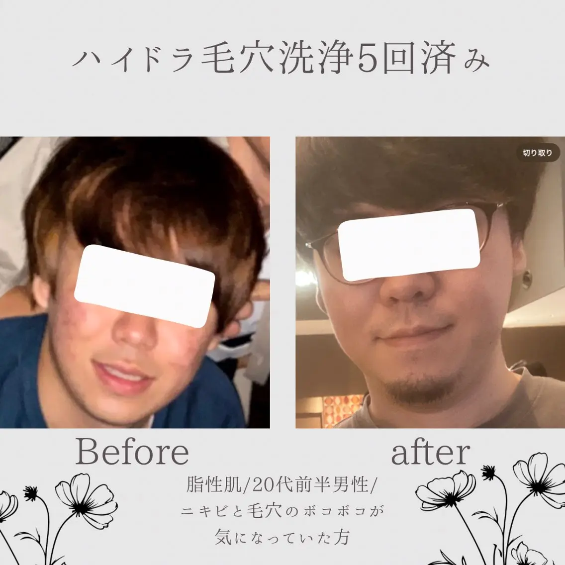 【肌質改善・腸揉み】 Nico laughのその他イメージ