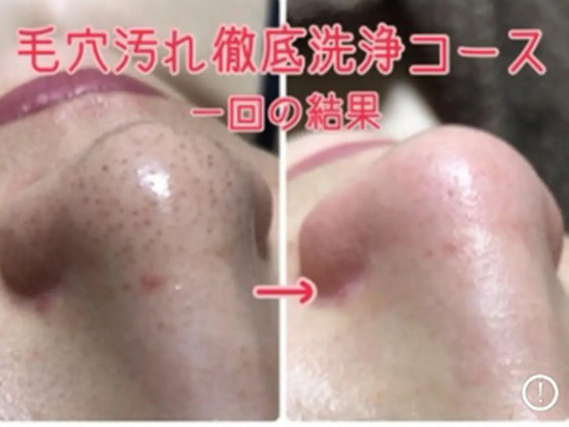 トータルビューティー サロンワンダーのネイルデザイン