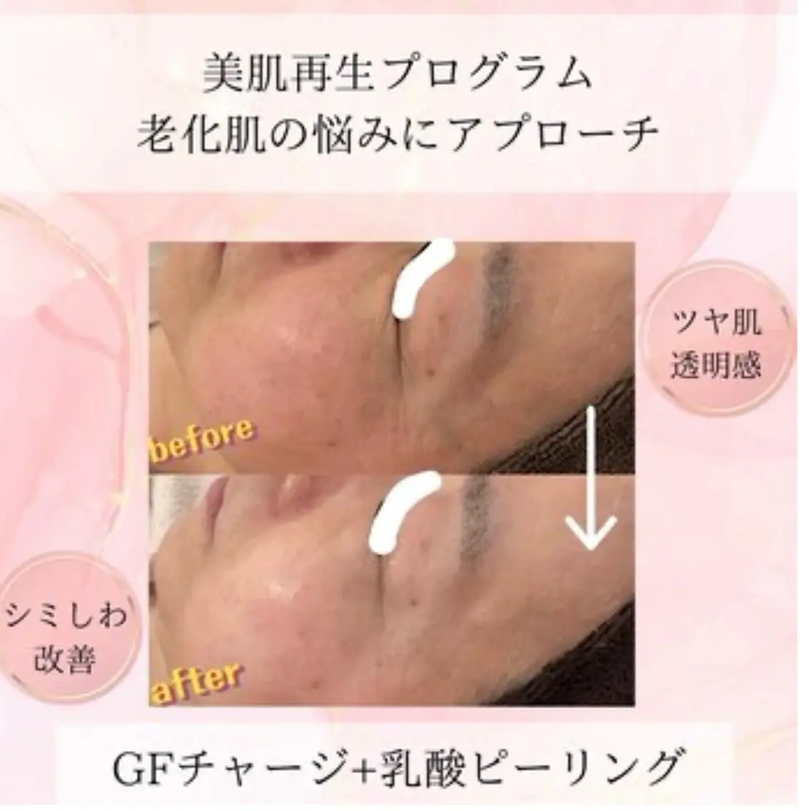 エステ beauty SalonRcoinのマツエク・マツパデザイン