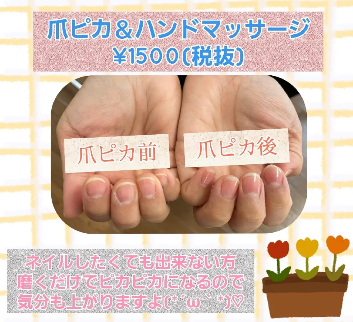 爪ピカハンドケアの写真