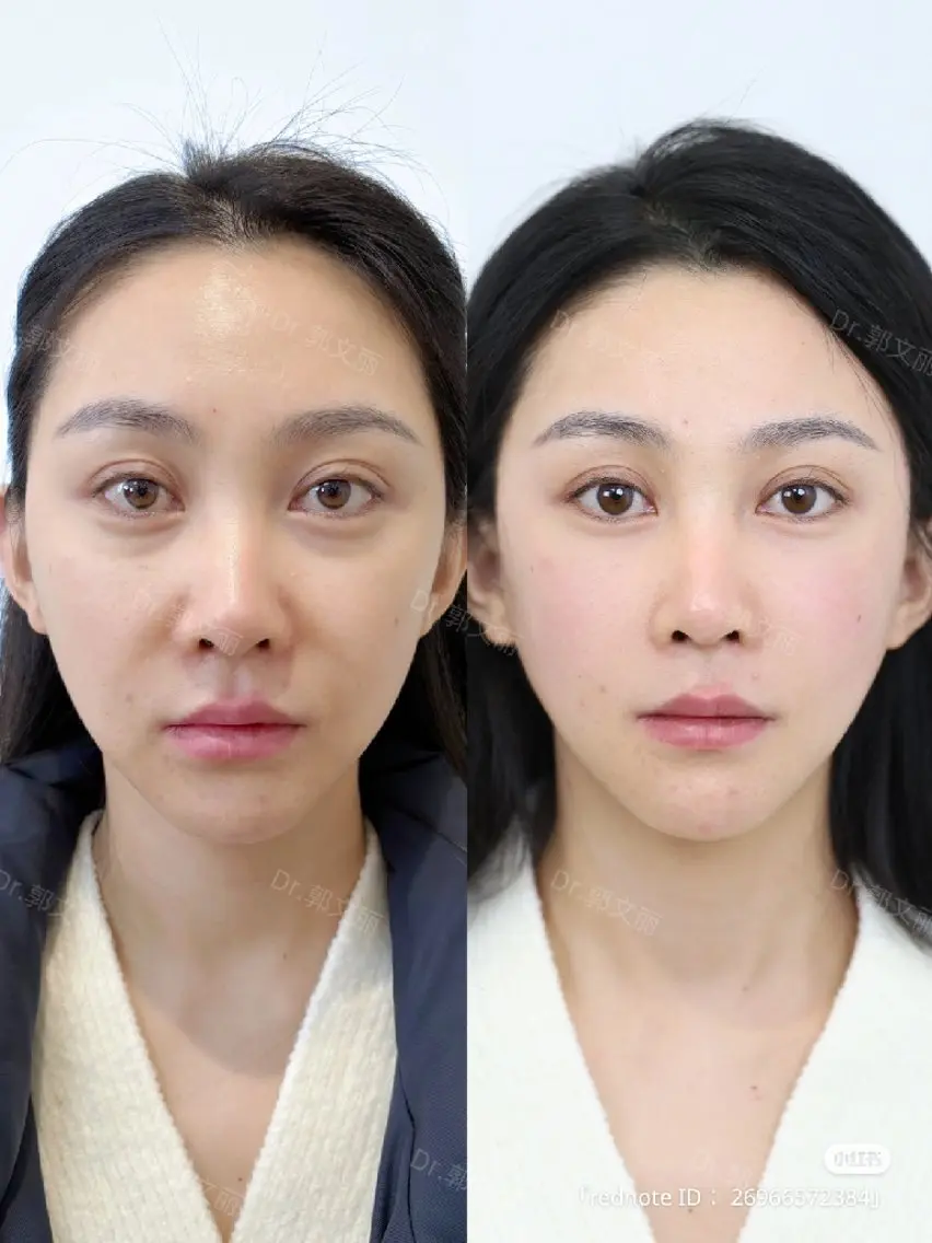 愛維美水光専門店 川崎彩鳳のエステ・リラクイメージ