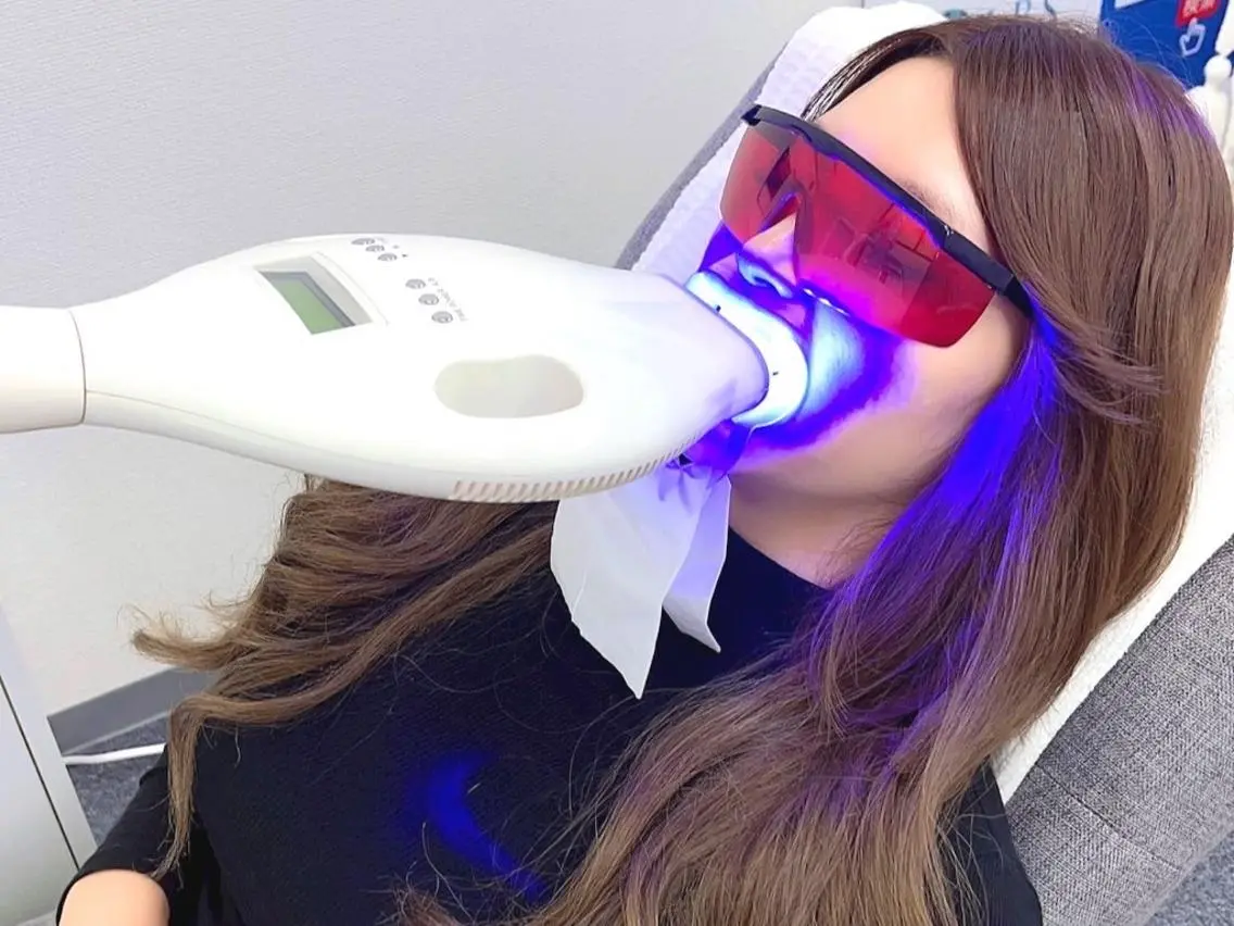 【サブスク定額プラン💎】セルフホワイトニングハイパワー5分照射🦷定額プラン💎の写真