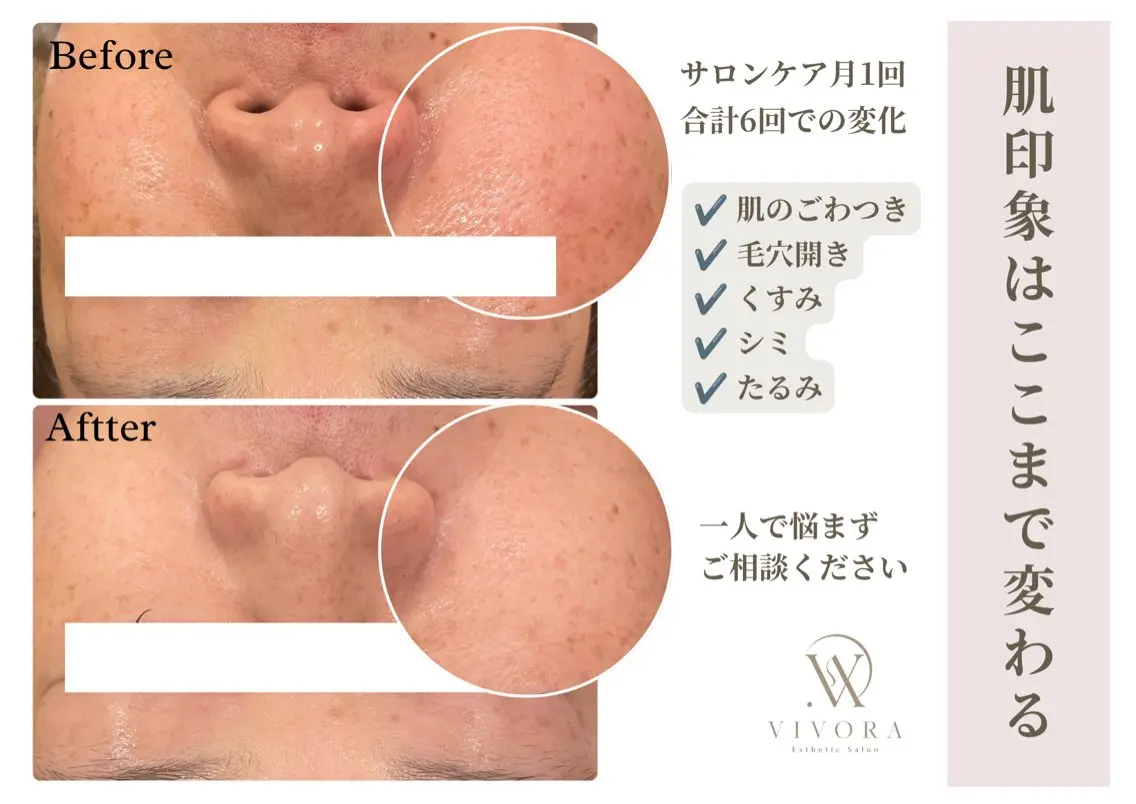 エステ VIVORA ASAMI🌿のエステ・リラクイメージ