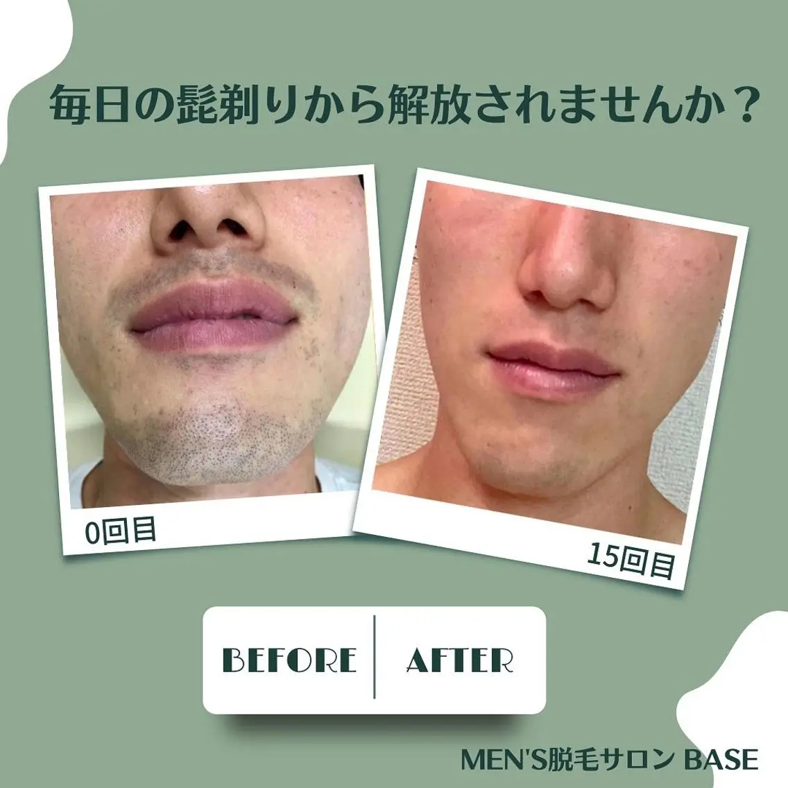 メンズ men's脱毛サロン BASEのエステ・リラクイメージ