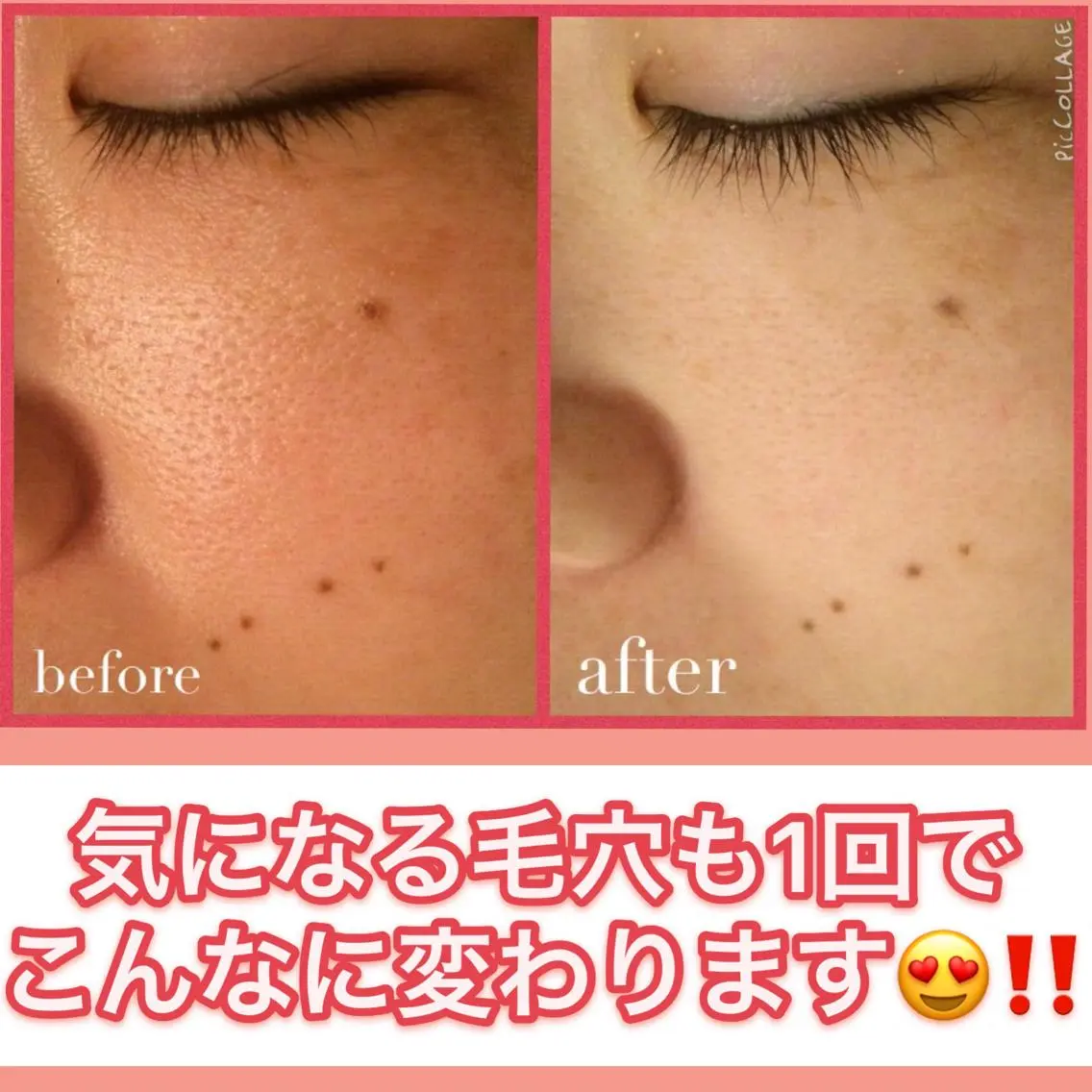 ミディアム カラー パーマ ヘアアレンジ メンズ キッズ ネイル マツエク・マツパ ニキビ・肌質改善専門 ♡人生が変わるサロンのエステ・リラクイメージ