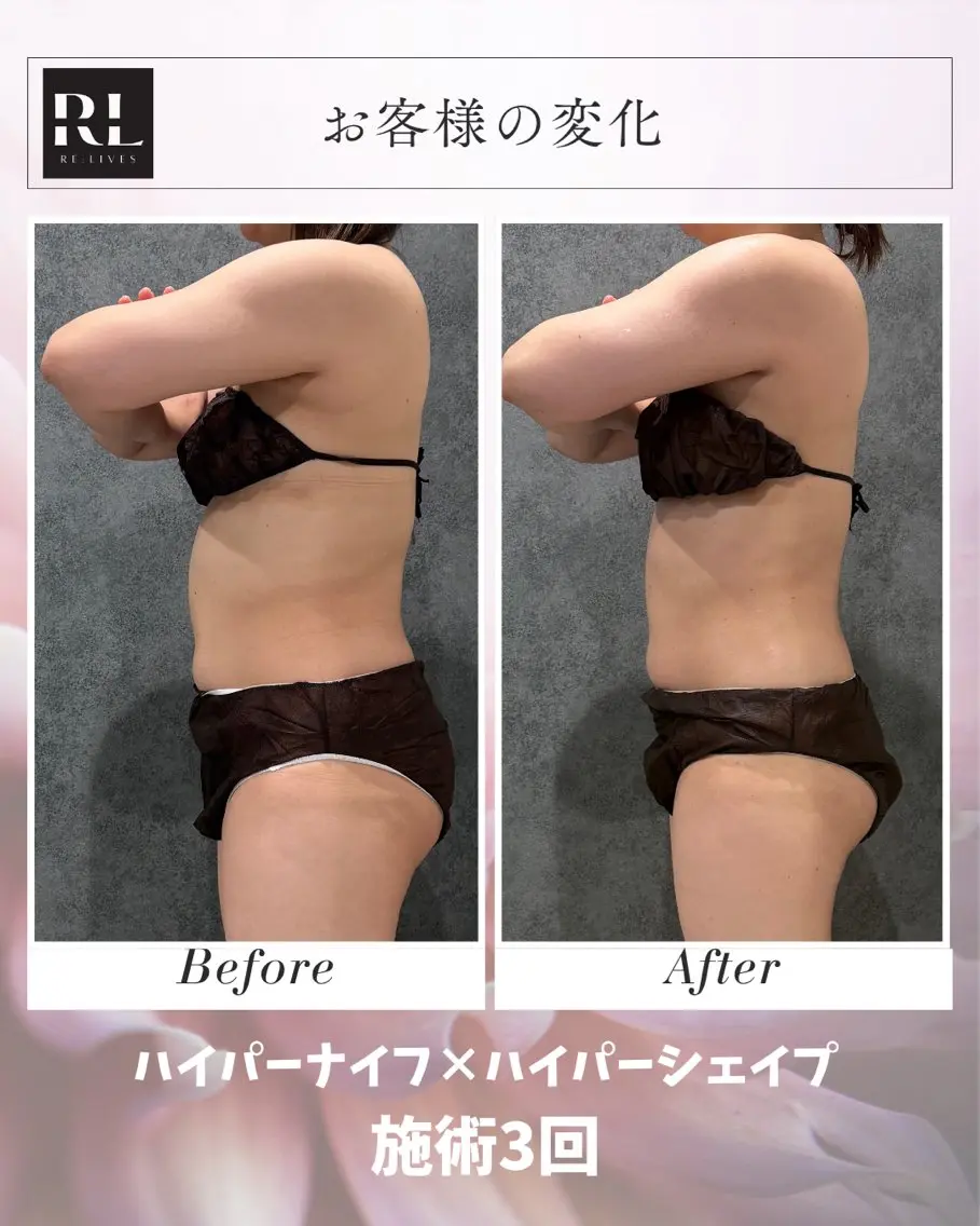 エステ 【痩身&美肌】 Re:Lives金町のエステ・リラクイメージ