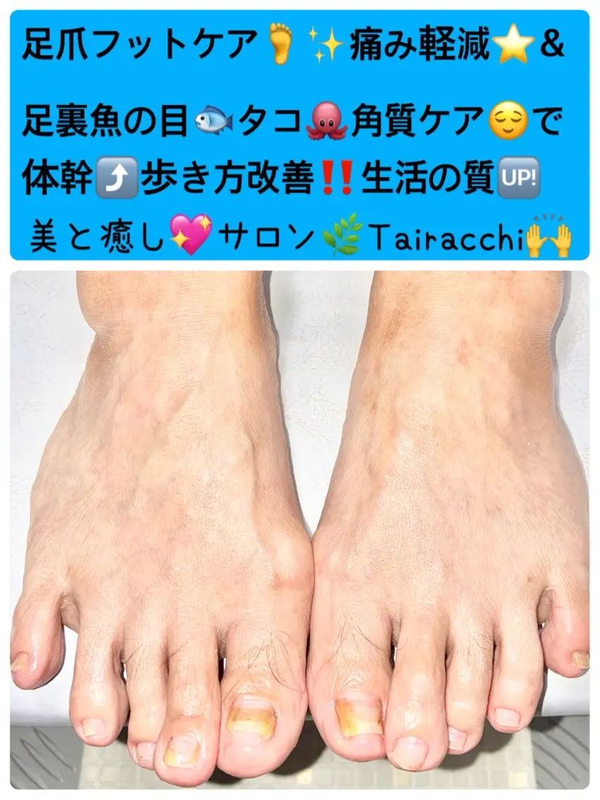 ネイル フットネイル Tairacchi ﾀｲﾗｯﾁのエステ・リラクイメージ