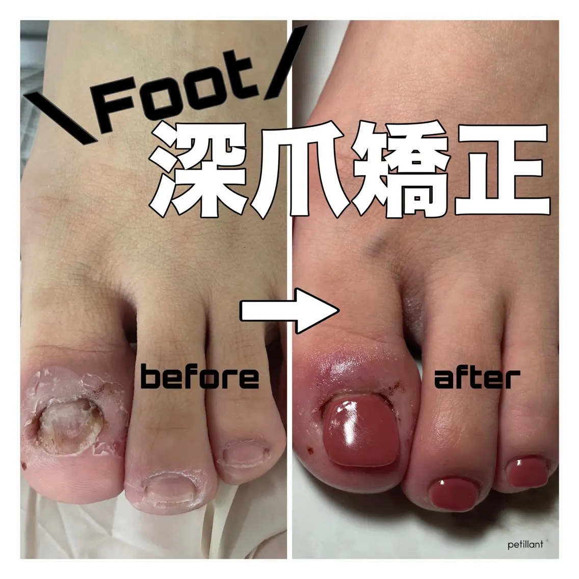 ネイル ブライダルネイル フットネイル nail salon petillantのネイルデザイン