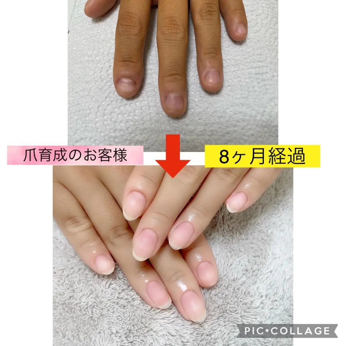 爪育成（モニター様価格）通常初回6500円（2回目以降5000円）の写真