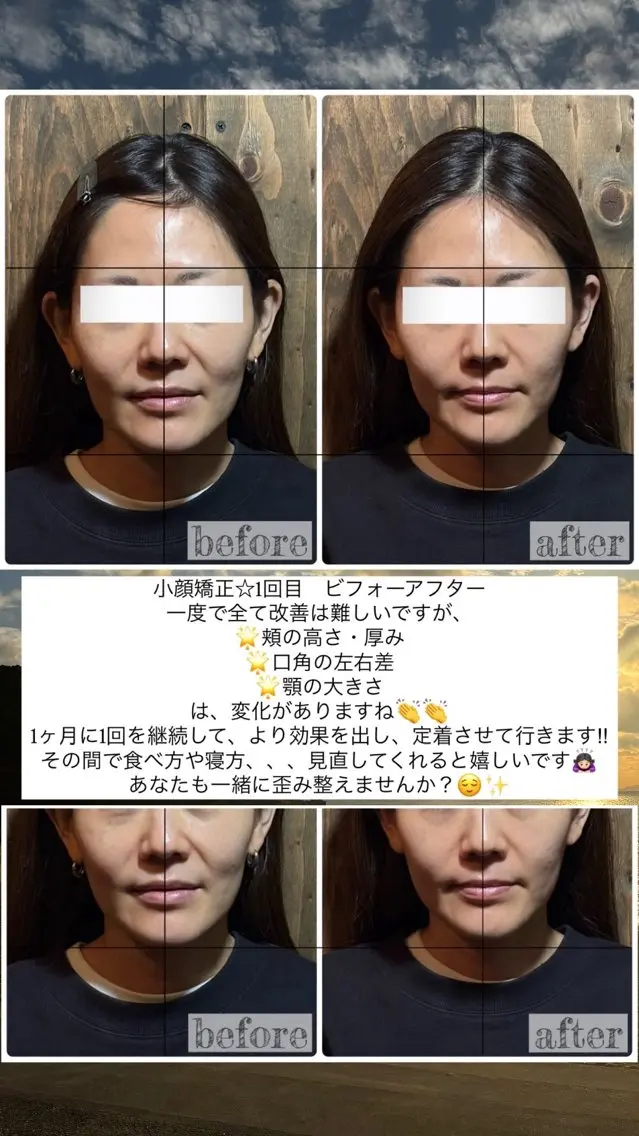 エステ リラク 💎後悔させない小顔 矯正💎イトヤマ🌱のエステ・リラクイメージ