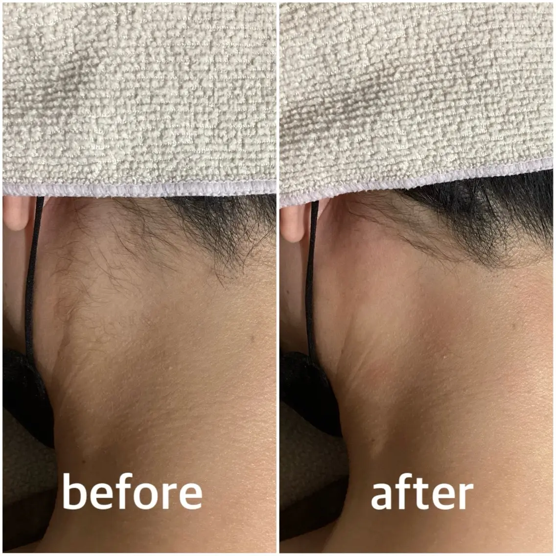 脱毛 Pullulant EstheKyotoのエステ・リラクイメージ