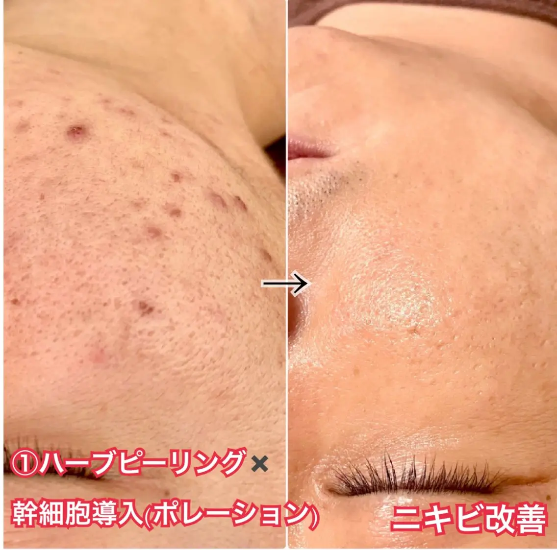 毛穴と美白の専門店 LAESSE 恵比寿のエステ・リラクイメージ