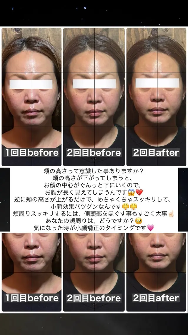 エステ リラク 💎後悔させない小顔 矯正💎イトヤマ🌱のエステ・リラクイメージ
