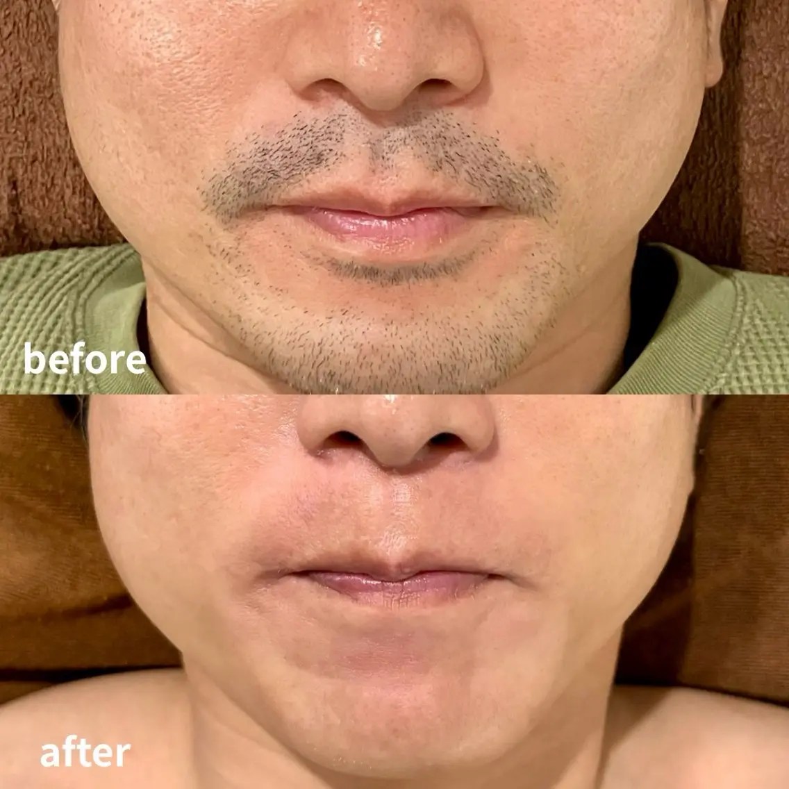 メンズ 脱毛 RICCO 堺の眉毛・アイブロウイメージ