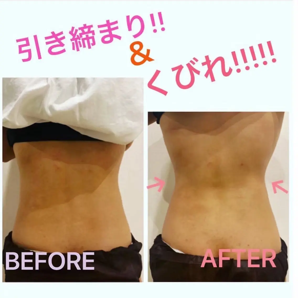 エステ ITO  SALON 小顔・痩身・肌質改善のエステ・リラクイメージ