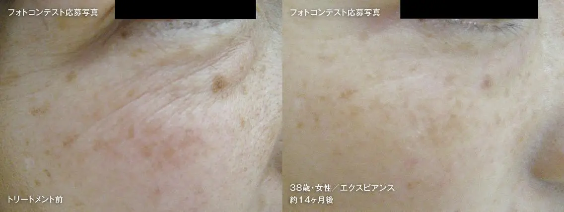 藤江 真弓のエステ・リラクイメージ