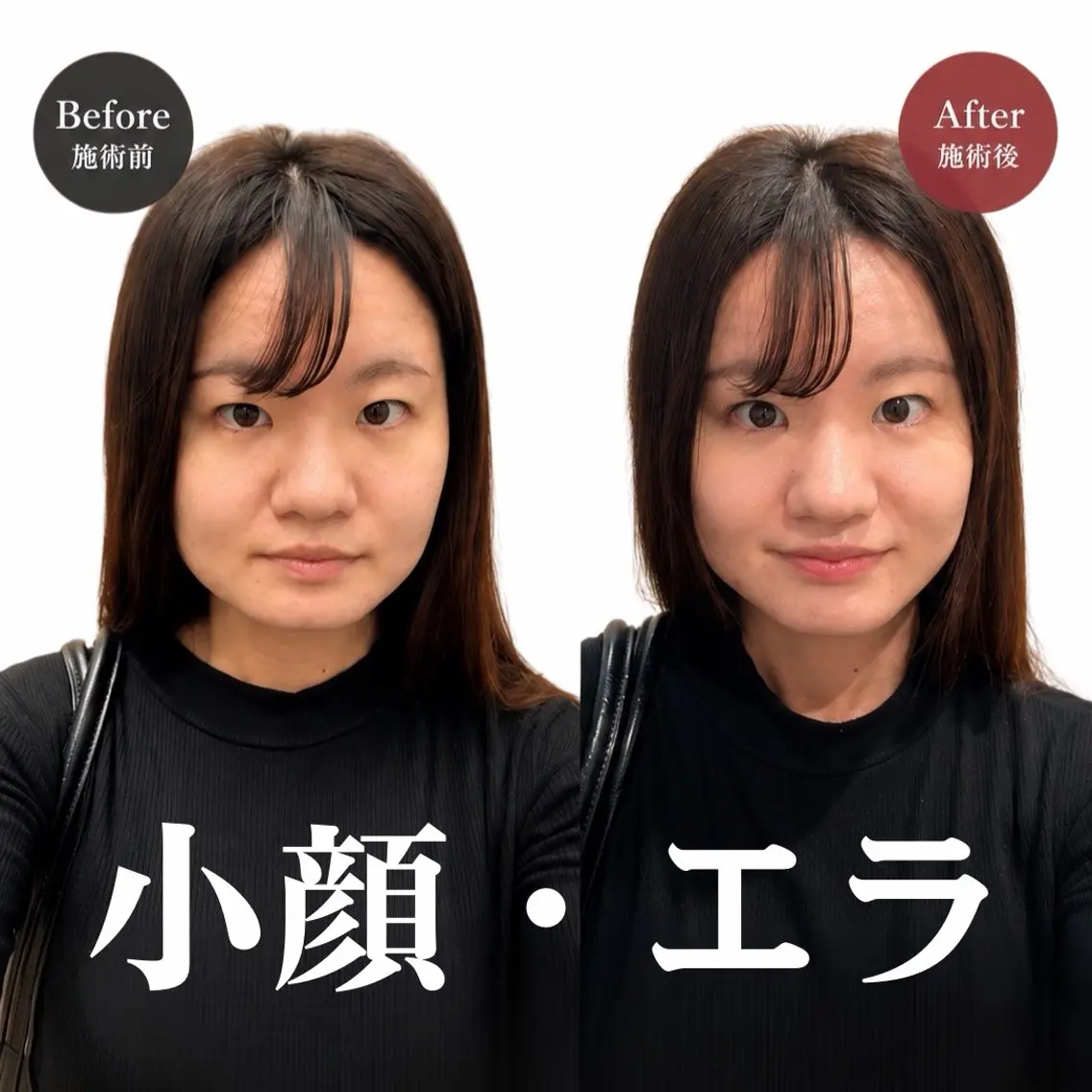 エステ リラク 美姿勢整体・美容鍼 田中愛奈のエステ・リラクイメージ