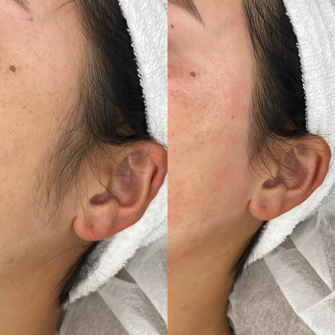 女性限定【フルフェイスWax 🥚】スキルアップレッスンモデルの写真