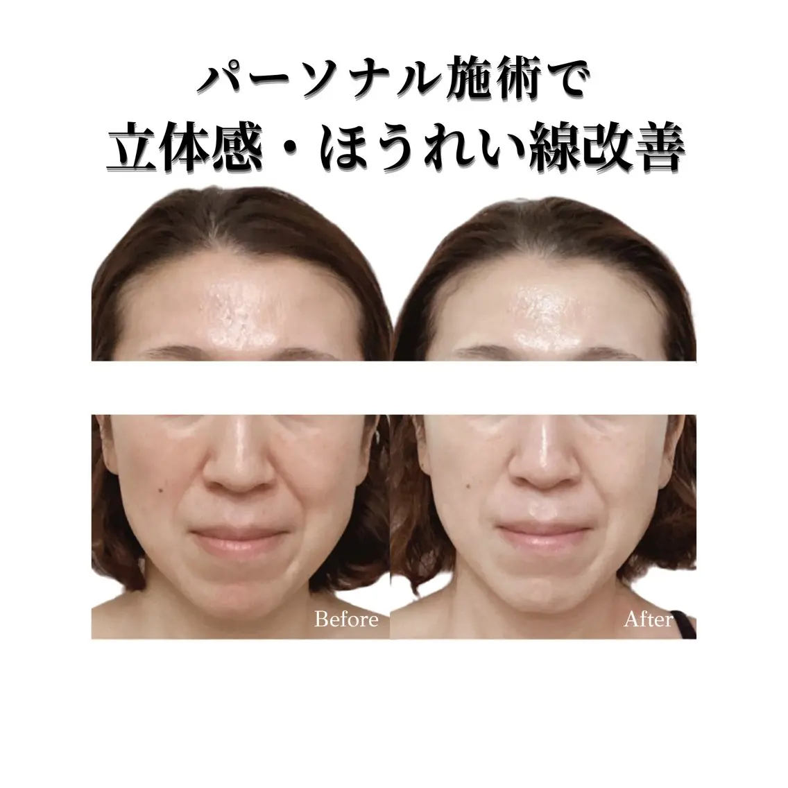 看護師 AYUIのエステ・リラクイメージ