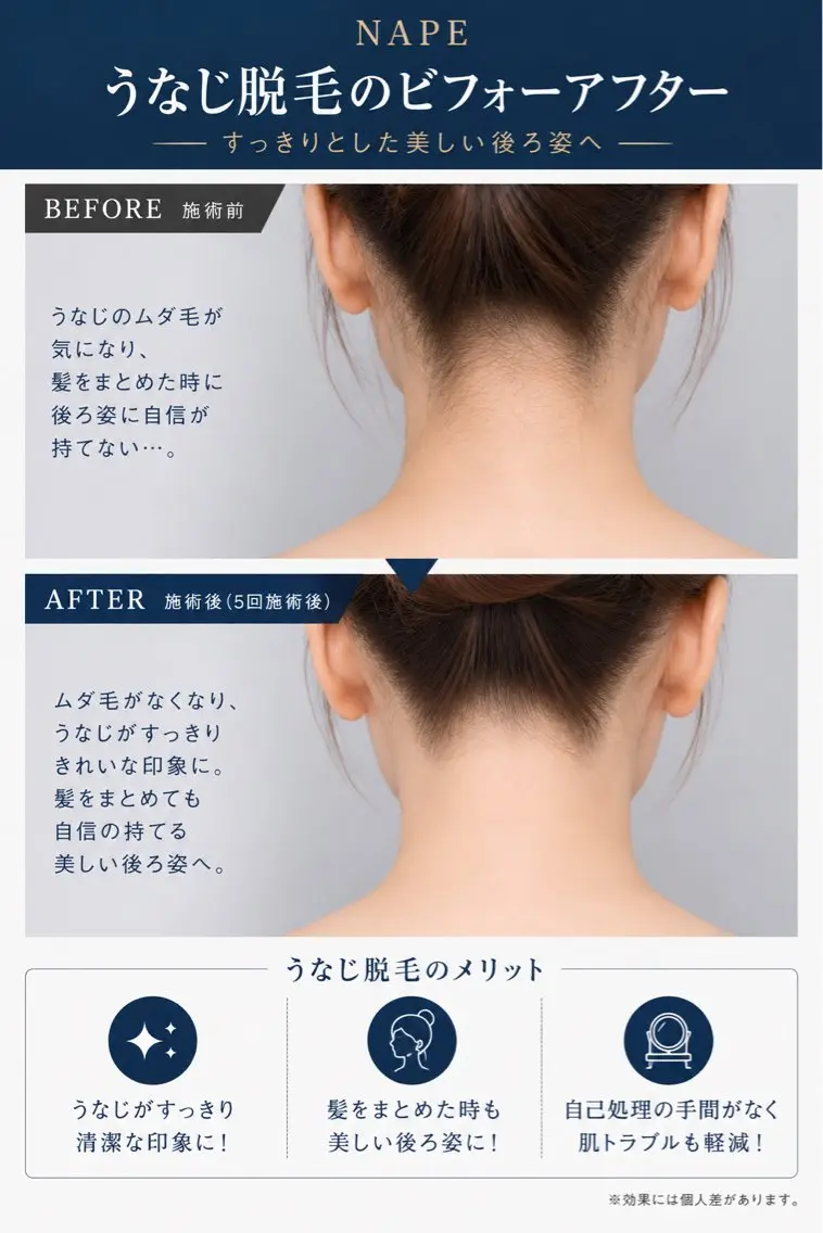 脱毛 💎脱毛💎IPL光 💎Maikaのエステ・リラクイメージ