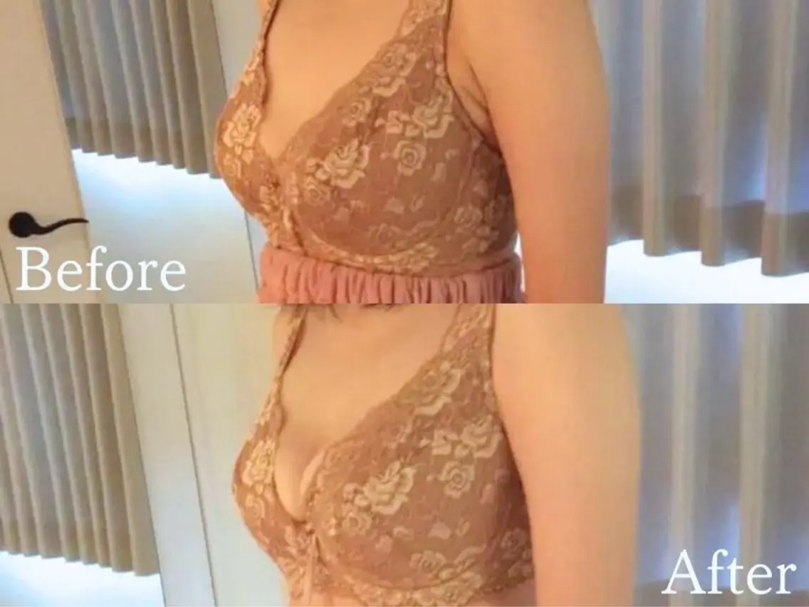 【産後授乳後ケア】上向きぷるぷるバストアップ&ハリ感バストUP90分¥16980の写真