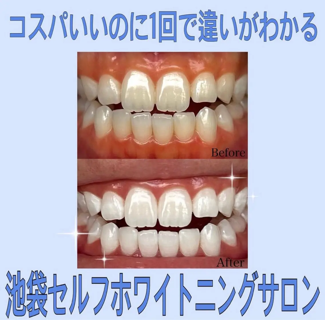 その他 ホワイトニングジム 池袋のその他イメージ