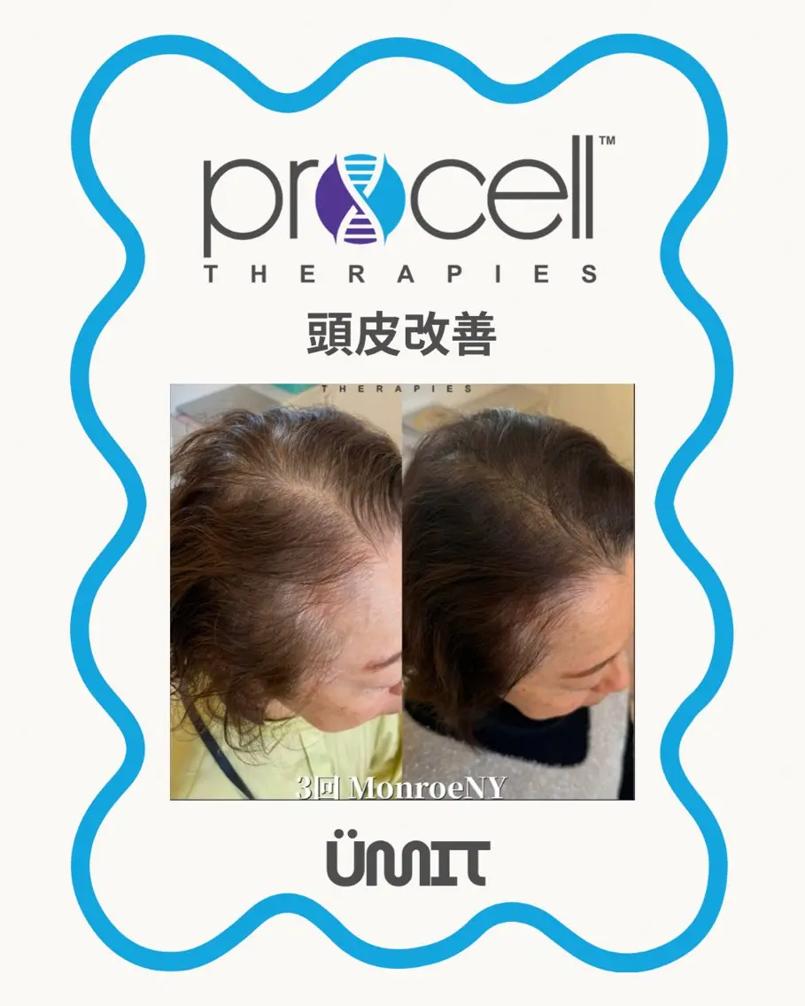 ヘッドスパ Ümit（ユミト） プロセルセラピーズのネイルデザイン
