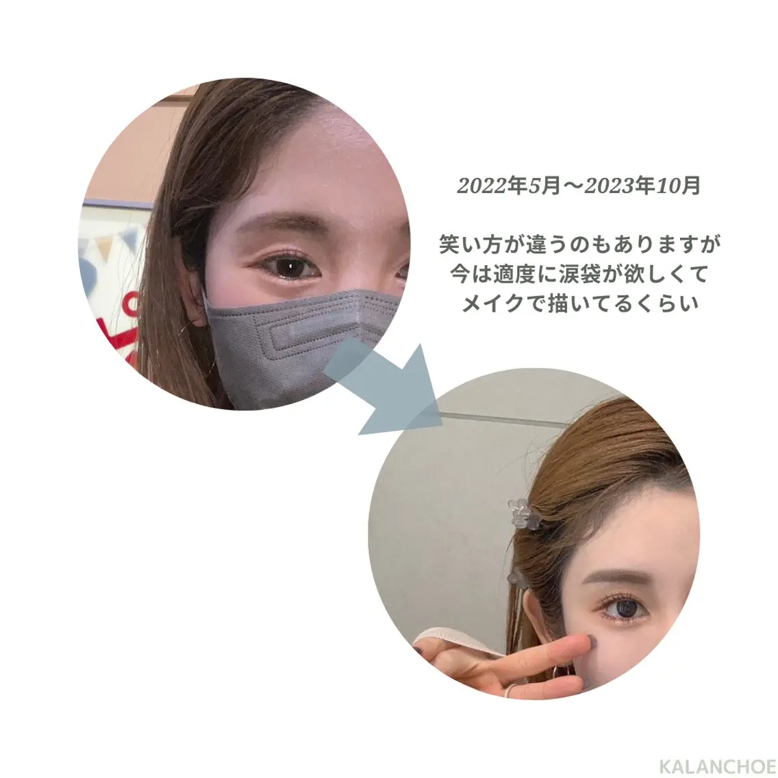 エステ 肌質改善 KALANCHOEのエステ・リラクイメージ
