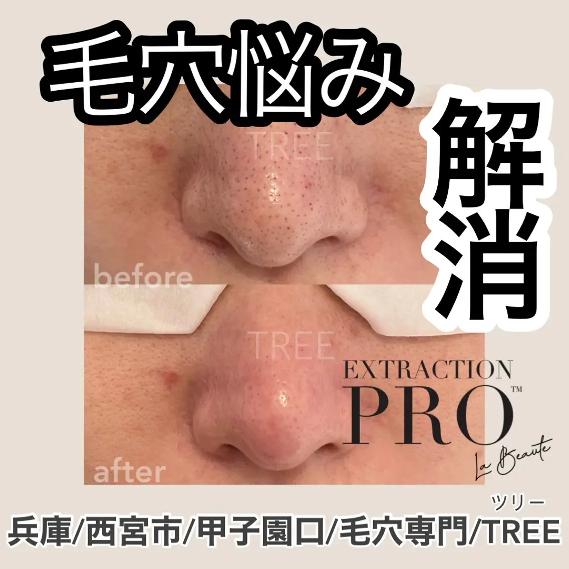 まつげ、毛穴 TREEのエステ・リラクイメージ